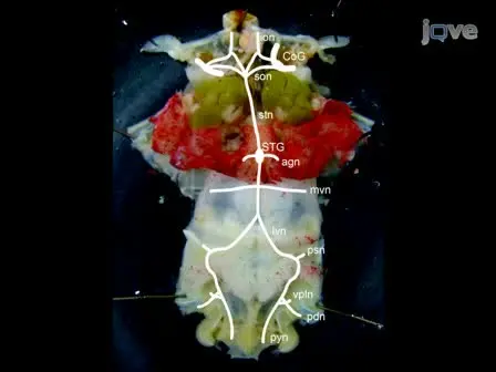 <em>Homarus Americanus</em> Stomatogastric Nervous System Dissection