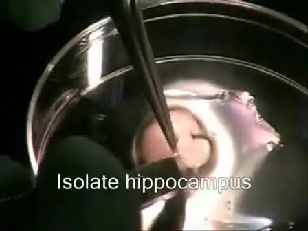 Gene-gun Transfection of Hippocampal Neurons