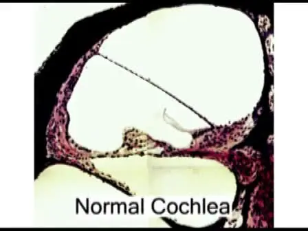Surgical Induction of Endolymphatic Hydrops by Obliteration of the Endolymphatic Duct
