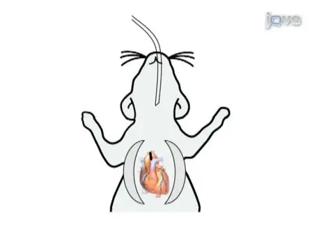 Transverse Aortic Constriction in Mice