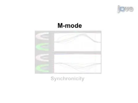 High-frequency High-resolution Echocardiography: First Evidence on Non-invasive Repeated Measure of Myocardial Strain, Contractility, and Mitral Regurgitation in the Ischemia-reperfused Murine Heart