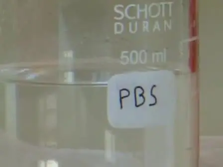 Isolation of Human Umbilical Arterial Smooth Muscle Cells (HUASMC)