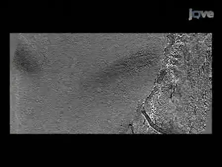 Electron Cryotomography of Bacterial Cells