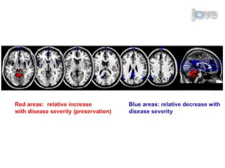 Basics of Multivariate Analysis in Neuroimaging Data