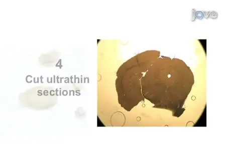 Preparation of Mouse Brain Tissue for Immunoelectron Microscopy