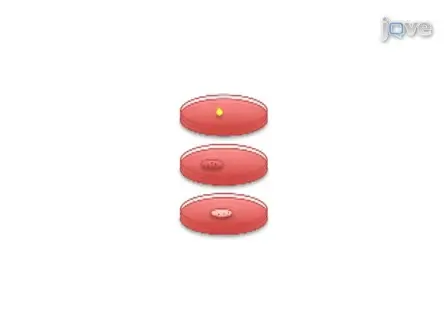 Transurethral Induction of Mouse Urinary Tract Infection