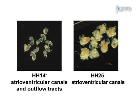 Isolation and Culture of Avian Embryonic Valvular Progenitor Cells