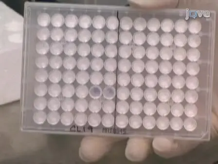 Enzyme-linked Immunospot Assay (ELISPOT):  Quantification of Th-1 Cellular Immune Responses Against Microbial Antigens