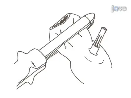 The C-seal: A Biofragmentable Drain Protecting the Stapled Colorectal Anastomosis from Leakage