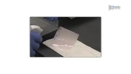 Western Blotting: Sample Preparation to Detection