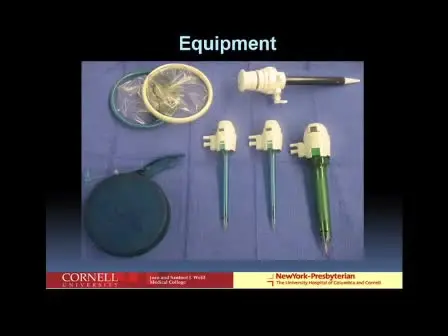 Single Port Donor Nephrectomy