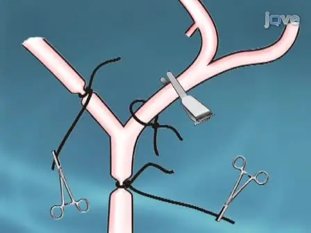 Modeling Stroke in Mice - Middle Cerebral Artery Occlusion with the Filament Model