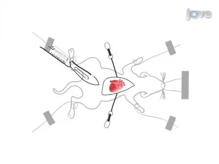 Use of a Hanging Weight System for Coronary Artery Occlusion in Mice