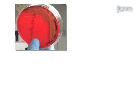 Subcutaneous Infection of Methicillin Resistant Staphylococcus Aureus (MRSA)