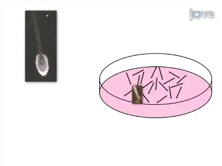 Isolation and Culture of Adult Epithelial Stem Cells from Human Skin