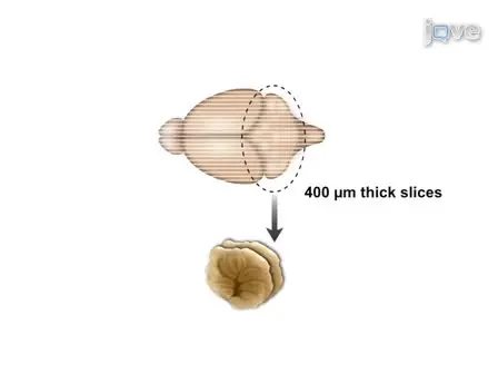Organotypic Cerebellar Cultures: Apoptotic Challenges and Detection