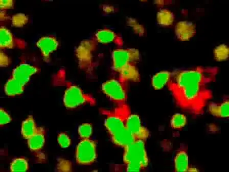 Regulatory T cells: Therapeutic Potential for Treating Transplant Rejection and Type I Diabetes