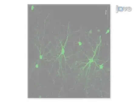 Whole Cell Recording from an Organotypic Slice Preparation of Neocortex