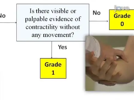 Manual Muscle Testing:  A Method of Measuring Extremity Muscle Strength Applied to Critically Ill Patients