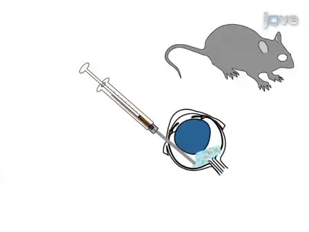 Establishment and Propagation of Human Retinoblastoma Tumors in Immune Deficient Mice