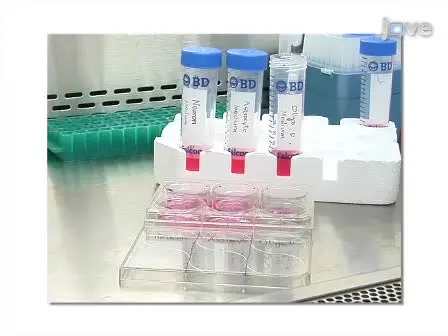 Generation of Neural Stem Cells from Discarded Human Fetal Cortical Tissue