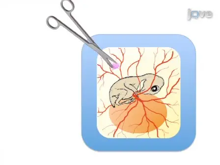 Evaluation of Nanoparticle Uptake in Tumors in Real Time Using Intravital Imaging