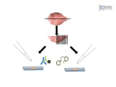 Detection of Neuritic Plaques in Alzheimer's Disease Mouse Model