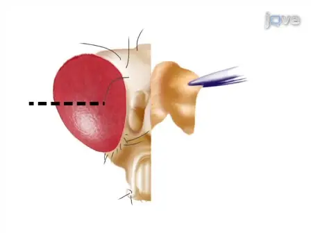 Single <em>Drosophila</em> Ommatidium Dissection and Imaging