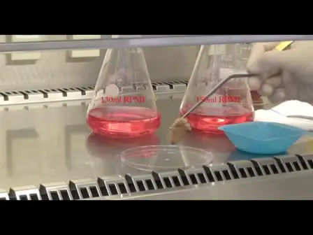 Isolation of Human Islets from Partially Pancreatectomized Patients