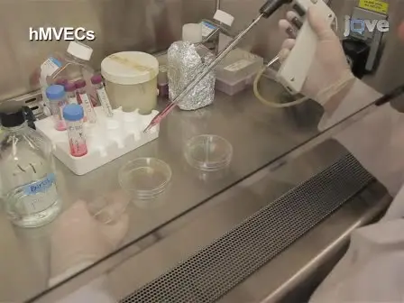 A Matrigel-Based Tube Formation Assay to Assess the Vasculogenic Activity of Tumor Cells