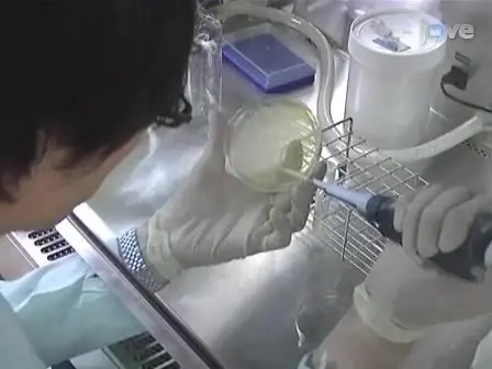 Application of a Mouse Ligated Peyer&#x2019;s Patch Intestinal Loop Assay to Evaluate Bacterial Uptake by M cells