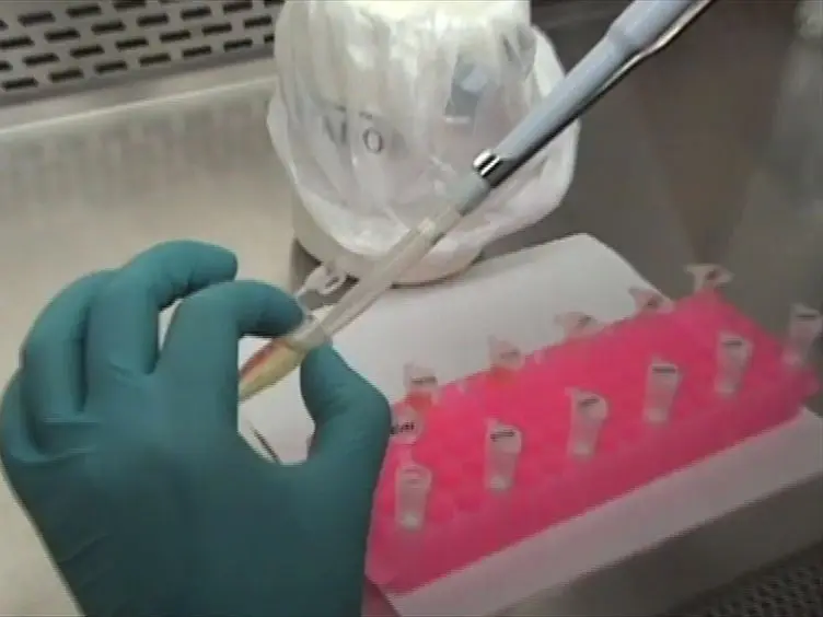 Detection and Genogrouping of Noroviruses from Children's Stools By Taqman One-step RT-PCR