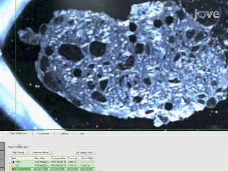 Heterogeneity Mapping of Protein Expression in Tumors using Quantitative Immunofluorescence