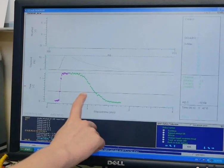 Nerve Excitability Assessment in Chemotherapy-induced Neurotoxicity