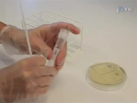 Quantitative Live Cell Fluorescence-microscopy Analysis of Fission Yeast