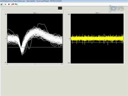 Surgical Implantation of Chronic Neural Electrodes for Recording Single Unit Activity and Electrocorticographic Signals