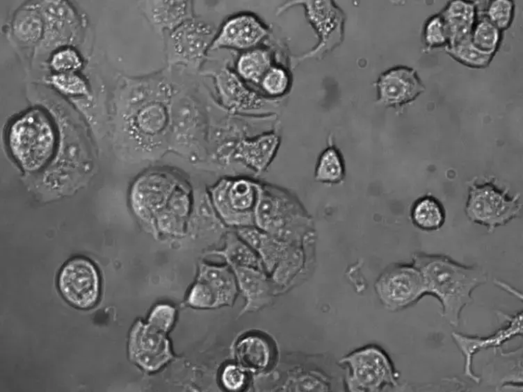 Enhancement of Apoptotic and Autophagic Induction by a Novel Synthetic C-1 Analogue of 7-deoxypancratistatin in Human Breast Adenocarcinoma and Neuroblastoma Cells with Tamoxifen