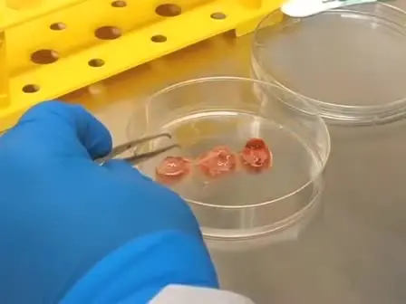 Isolation and Expansion of Human Glioblastoma Multiforme Tumor Cells Using the Neurosphere Assay
