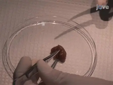 The CYP2D6 Animal Model: How to Induce Autoimmune Hepatitis in Mice