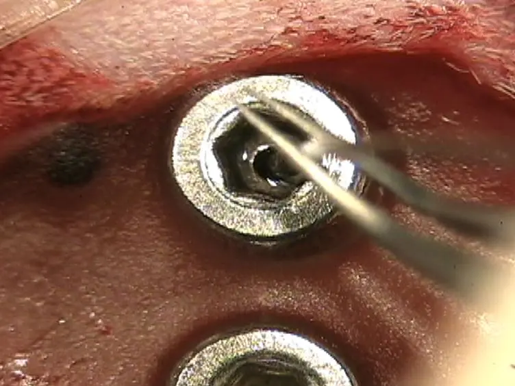 Epidural Intracranial Pressure Measurement in Rats Using a Fiber-optic Pressure Transducer