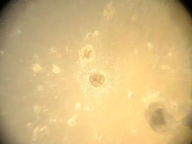 Isolation of Mammary Epithelial Cells from Three-dimensional Mixed-cell Spheroid Co-culture