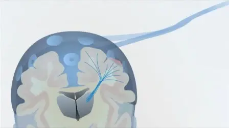 Preterm EEG: A Multimodal Neurophysiological Protocol
