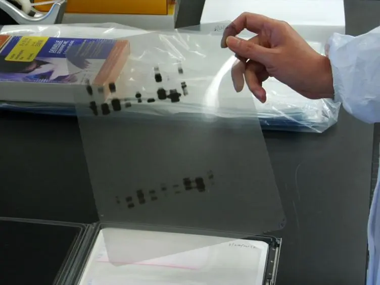 Isolation of Soluble and Insoluble PrP Oligomers in the Normal Human Brain