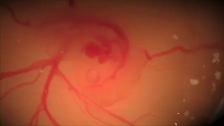 <em>In Ovo</em> Electroporation in Embryonic Chick Retina