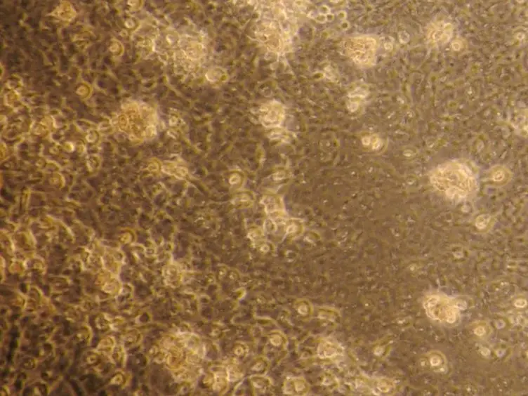 Primary Microglia Isolation from Mixed Glial Cell Cultures of Neonatal Rat Brain Tissue