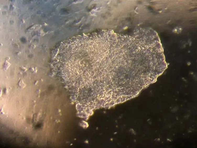 Rapid Fibroblast Removal from High Density Human Embryonic Stem Cell Cultures
