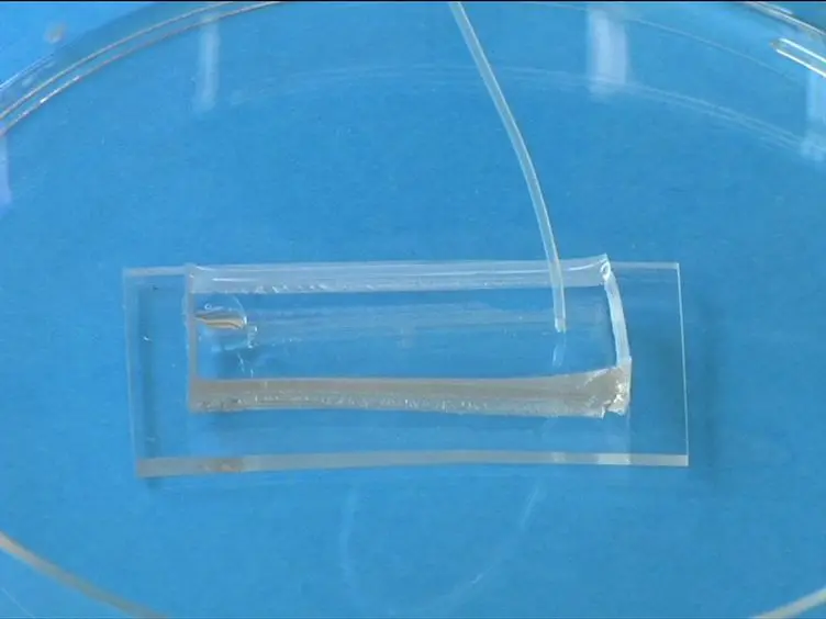 Endothelialized Microfluidics for Studying Microvascular Interactions in Hematologic Diseases