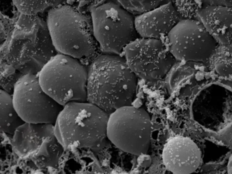 A Human Fallopian Tube Model for Investigation of <em>C. trachomatis</em> Infections