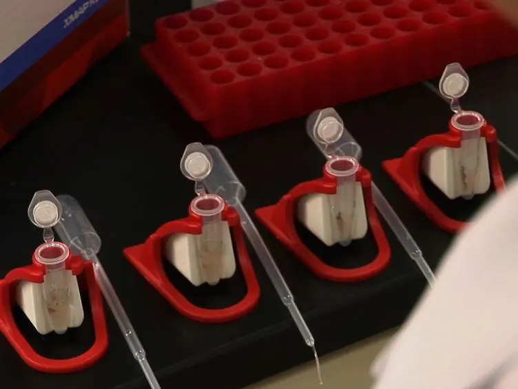 Conversion of a Capture ELISA to a Luminex xMAP Assay using a Multiplex Antibody Screening Method