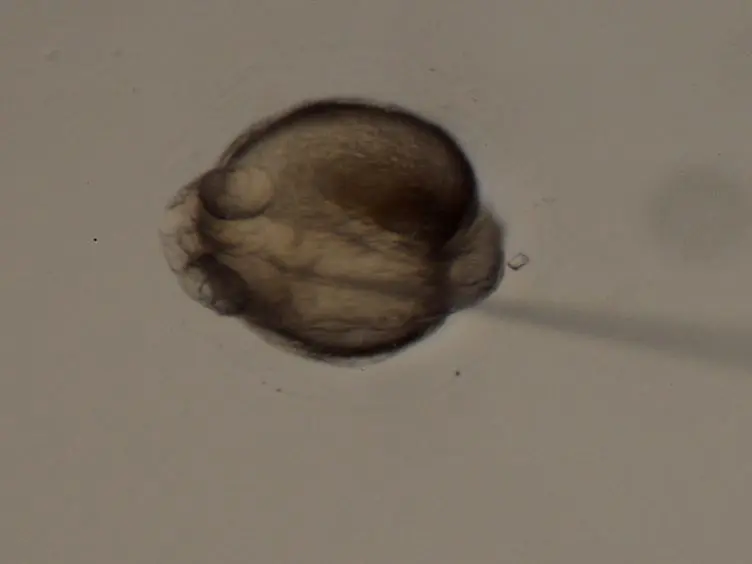 Manual Drainage of the Zebrafish Embryonic Brain Ventricles